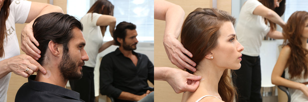 Hair-Replacement-Naperville Hair Replacement Naperville